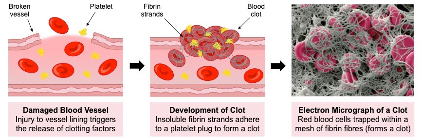 clotting